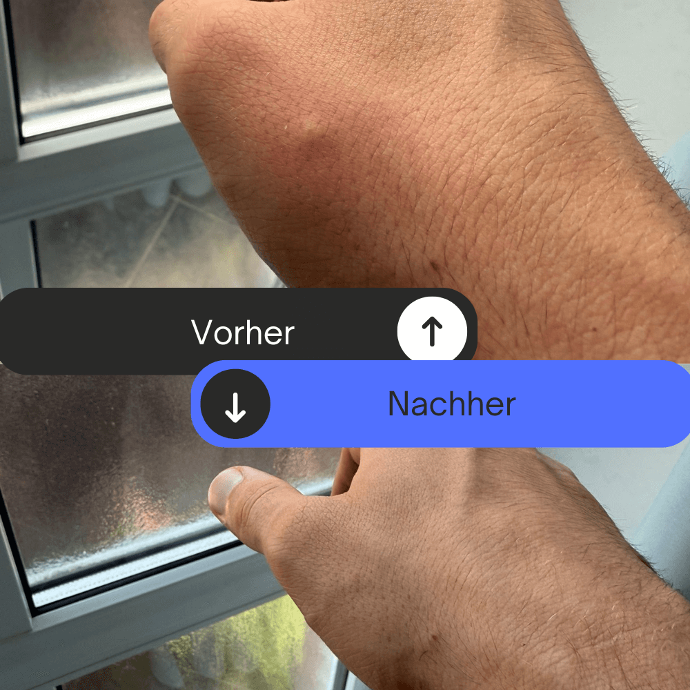 Anti-Mücken Armband | Ab der ersten Anwendung stichfrei!